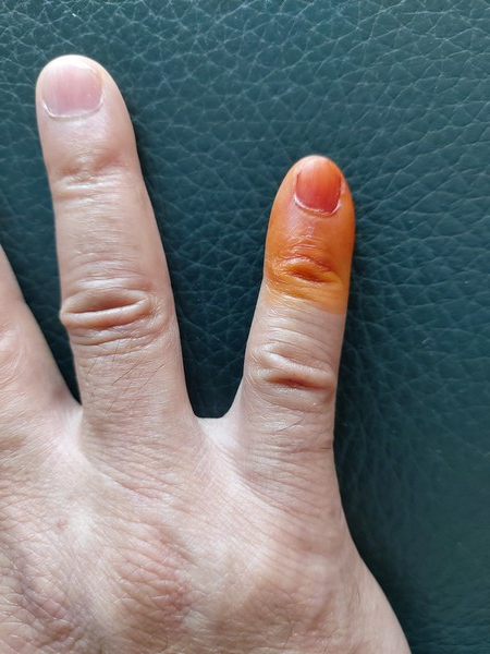 봉숭아꽃 필 무렵 내가 막내였을 때 엄마는